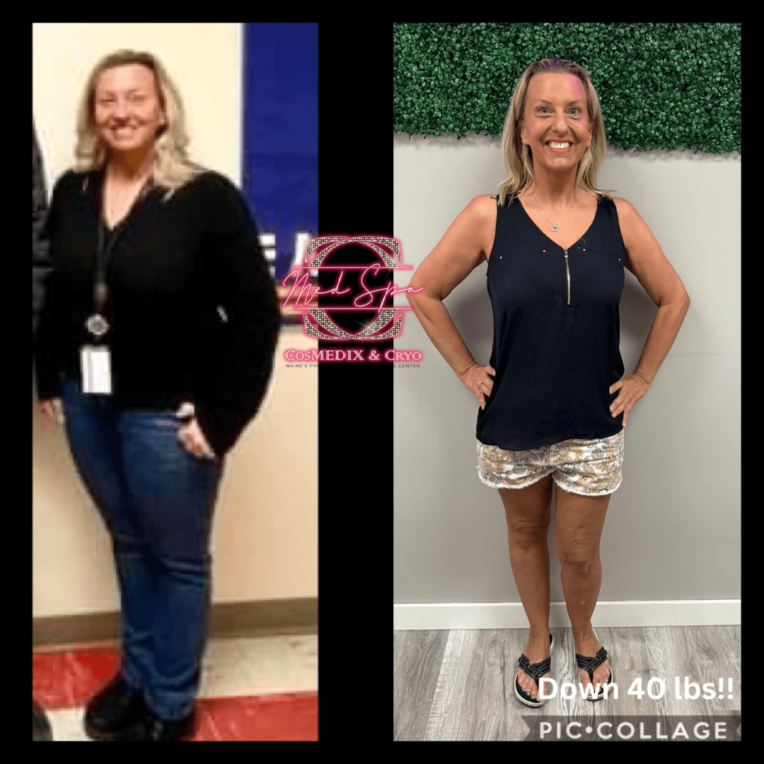 A before and after picture of a woman in shorts.